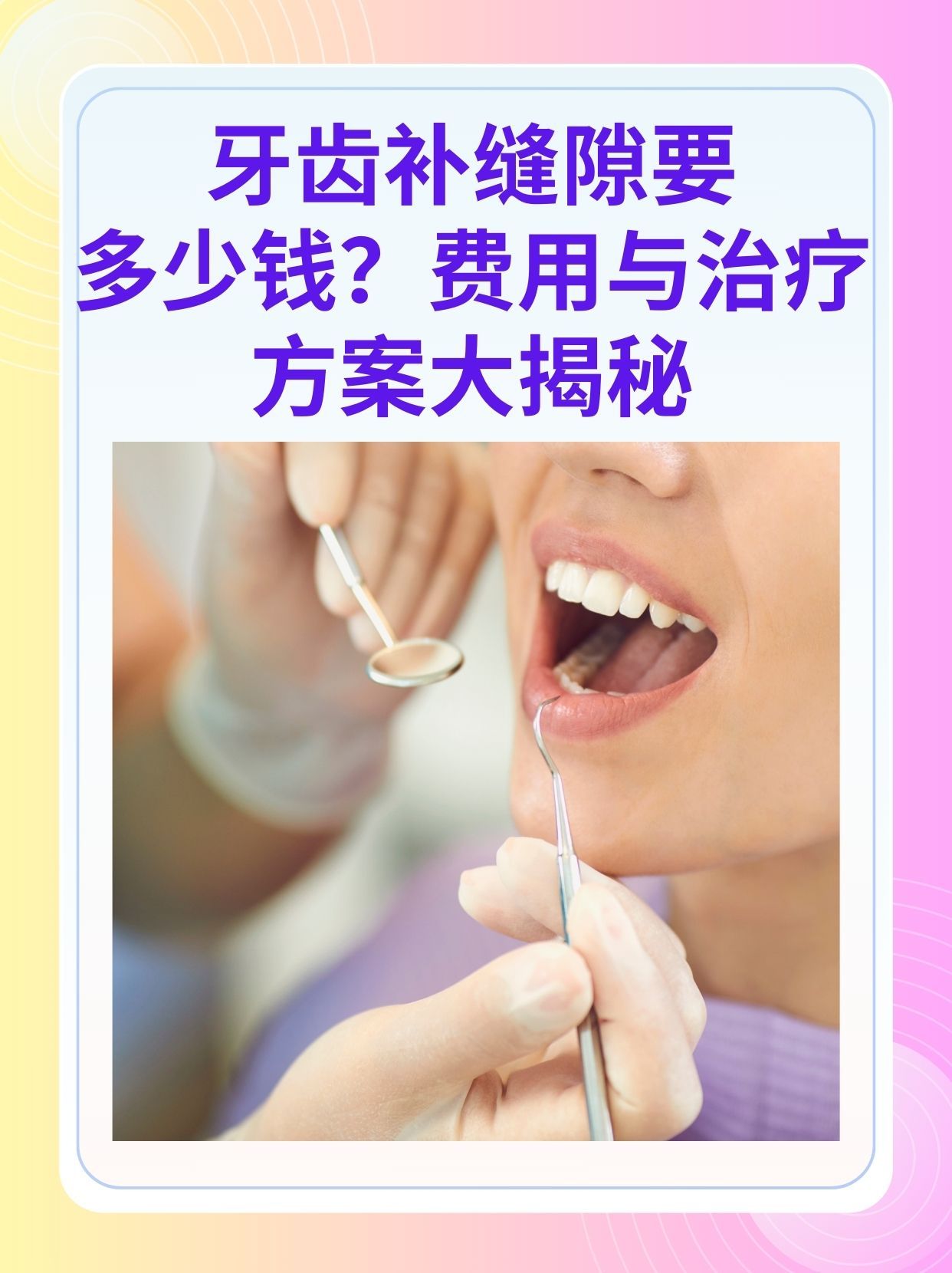 长春补牙医保可以报销吗(补牙医保可以报销吗 哪些可以报销呢)